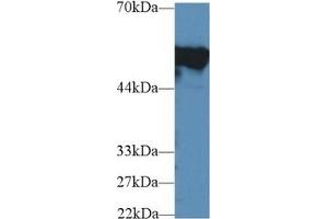 Western Blotting (WB) image for anti-Fibrinogen beta Chain (FGB) (AA 35-481) antibody (ABIN7433273)