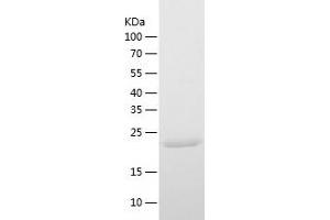 Western Blotting (WB) image for Fumarylacetoacetate Hydrolase Domain Containing 1 (FAHD1) (AA 1-224) protein (His tag) (ABIN7123018) (FAHD1 Protein (AA 1-224) (His tag))