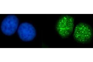 IF analysis of ATRIP using anti-ATRIP antibody (ABIN7599701).