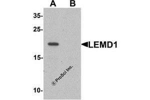 Western Blotting (WB) image for anti-LEM Domain Containing 1 (LEMD1) (Middle Region) antibody (ABIN1030979)