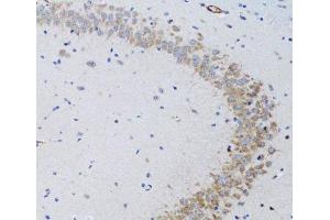 Immunohistochemistry of paraffin-embedded Rat brain using TNFSF12 Polyclonal Antibody at dilution of 1:100 (20x lens). (TWEAK antibody)