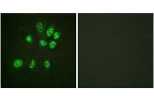 Immunofluorescence analysis of HeLa cells, using Estrogen Receptor-beta (Ab-105) Antibody. (ESR2 antibody  (AA 71-120))