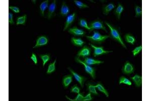 Immunofluorescence staining of A549 cells with ABIN7175266 at 1:133, counter-stained with DAPI. (ATP6V1G2 antibody  (AA 1-118))