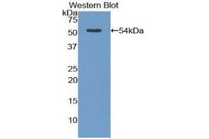 Western Blotting (WB) image for anti-Adiponectin Receptor 2 (ADIPOR2) (AA 180-367) antibody (ABIN1857920) (Adiponectin Receptor 2 antibody  (AA 180-367))