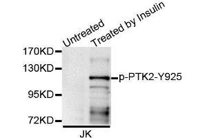 Western blot analysis of extracts of Jurkat cell line, using Phospho-PTK2-Y925 antibody (ABIN5995626). (FAK antibody  (pTyr925))