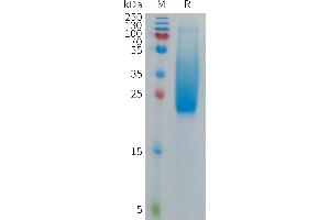 Interleukin 18 Binding Protein (IL18BP) (AA 28-207) protein (His tag)