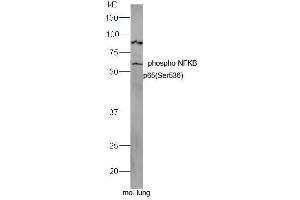 Mouse lung lysates probed with Rabbit Anti-NFkB p65 (Ser536) Polyclonal Antibody, Unconjugated  at 1:5000 for 90 min at 37˚C. (NF-kB p65 antibody  (pSer536))