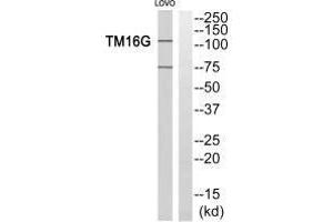 Western blot analysis of extracts from LOVO cells, using TM16G antiobdy. (Anoctamin 7 antibody  (C-Term))