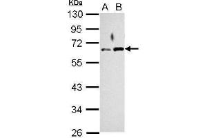 WB Image Sample (30 ug of whole cell lysate) A: Jurkat B: K562 10% SDS PAGE antibody diluted at 1:1000 (RAD9A antibody  (Center))