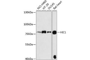 Western blot analysis of extracts of various cell lines, using HIC1 antibody (ABIN6128076, ABIN6141753, ABIN6141755 and ABIN6225059) at 1:3000 dilution. (HIC1 antibody  (AA 180-430))