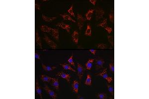 Immunofluorescence analysis of NIH-3T3 cells using Bax Rabbit mAb  at dilution of 1:100 (40x lens).