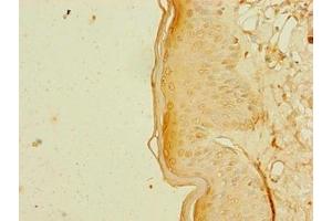 Immunohistochemistry of paraffin-embedded human skin tissue using ABIN7168349 at dilution of 1:100 (RBM41 antibody  (AA 1-413))