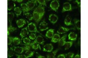 Immunostaining of HeLa cells with the anti-mitochondria antibody. (Mitochondria antibody)