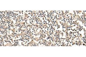 Immunohistochemistry of paraffin-embedded Human tonsil tissue using MAGEA1 Polyclonal Antibody at dilution of 1:65(x200) (MAGEA1 antibody)
