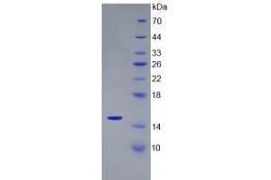 SDS-PAGE of Protein Standard from the Kit (Highly purified E. (CST3 ELISA Kit)
