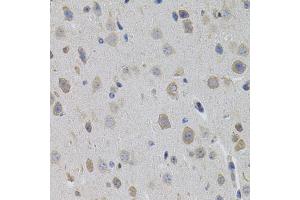 Immunohistochemistry of paraffin-embedded mouse brain using SUMO3 antibody (ABIN5971585) (40x lens). (SUMO3 antibody)