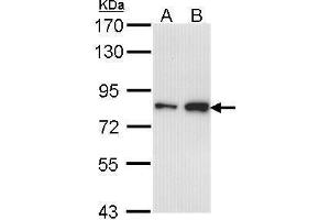 WB Image Sample (30 ug of whole cell lysate) A: A431 , B: H1299 7. (CTDP1 antibody  (N-Term))