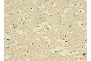 Immunohistochemistry (IHC) image for anti-Cytochrome P450, Family 2, Subfamily E, Polypeptide 1 (CYP2E1) (AA 49-288) antibody (ABIN7149247)