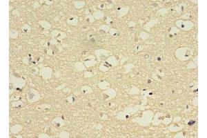 Immunohistochemistry of paraffin-embedded human brain tissue using ABIN7149247 at dilution of 1:100 (CYP2E1 antibody  (AA 49-288))