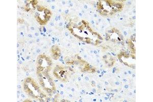 Immunohistochemistry of paraffin-embedded Rat kidney using FABP5 Polyclonal Antibody at dilution of 1:100 (40x lens). (FABP5 antibody)