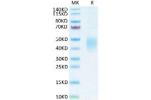 CD74 Protein (AA 56-279) (His tag)