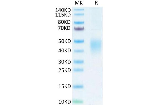 CD74 Protein (AA 56-279) (His tag)