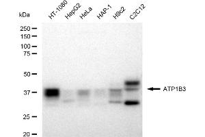 Western blotting analysis using ATP1B3 antibody (ABIN7797700).