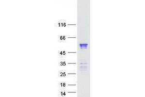 Validation with Western Blot (NUP50 Protein (Transcript Variant 3) (Myc-DYKDDDDK Tag))
