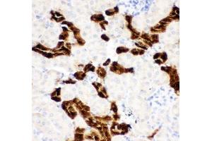 Immunohistochemistry (IHC) image for anti-Calbindin (CALB1) (AA 2-175) antibody (ABIN3030248)