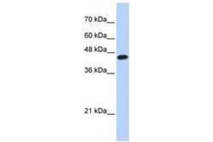 Image no. 1 for anti-E2F Transcription Factor 1 (E2F1) (AA 107-156) antibody (ABIN6741507) (E2F1 antibody  (AA 107-156))