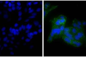 Human epithelial carcinoma cell line HEp-2 was stained with Mouse Anti-Human CD44-UNLB, and DAPI. (Goat anti-Mouse Ig (Heavy & Light Chain) Antibody (Biotin))