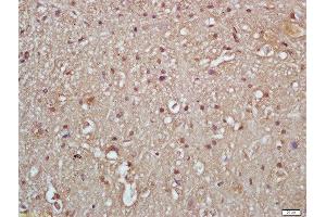 Immunohistochemistry (Paraffin-embedded Sections) (IHC (p)) image for anti-Inhibitor of kappa Light Polypeptide Gene Enhancer in B-Cells, Kinase gamma (IKBKG) (pSer376) antibody (ABIN743213)