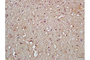 Formalin-fixed and paraffin embedded rat brain labeled with Rabbit Anti-IKK gamma (Ser376) Polyclonal Antibody, Unconjugated  at 1:200 followed by conjugation to the secondary antibody and DAB staining