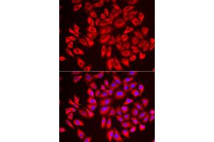 Immunofluorescence analysis of U2OS cells using DCAF7 antibody. (DCAF7 antibody)