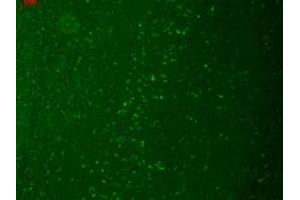 Immunofluorescence (IF) image for anti-Transient Receptor Potential Cation Channel, Subfamily M, Member 7 (TRPM7) (C-Term) antibody (ABIN6657588)