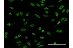 Immunofluorescence of purified MaxPab antibody to EWSR1 on HeLa cell. (EWSR1 antibody  (AA 1-656))