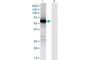 Western Blot analysis of UGT2B7 expression in transfected 293T cell line by UGT2B7 monoclonal antibody (M02), clone 8D12. (UGT2B7 antibody  (AA 69-157))