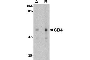 Western Blotting (WB) image for anti-CD4 (CD4) (N-Term) antibody (ABIN492543) (CD4 antibody  (N-Term))