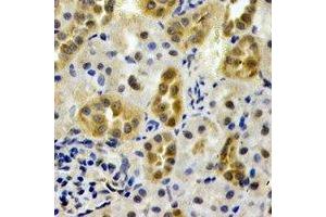 Immunohistochemical analysis of AHCYL1 staining in rat kidney formalin fixed paraffin embedded tissue section. (AHCYL1 antibody)