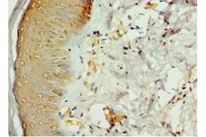 Immunohistochemistry of paraffin-embedded human skin tissue using ABIN7168977 at dilution of 1:100 (STK16 antibody  (AA 1-305))