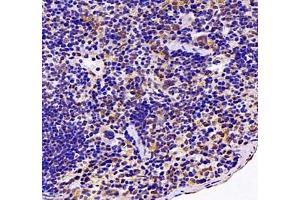 Immunohistochemistry (Paraffin-embedded Sections) (IHC (p)) image for anti-Endonuclease VIII-Like 1 (NEIL1) antibody (ABIN7073820)