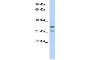 WB Suggested Anti-C17orf81 Antibody Titration: 0. (Retinoic Acid Induced 12 (RAI12) (Middle Region) antibody)