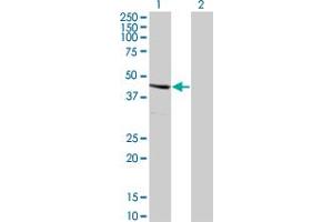 Western Blot analysis of SERPINE2 expression in transfected 293T cell line by SERPINE2 monoclonal antibody (M01), clone 3G12. (SERPINE2 antibody  (AA 72-172))