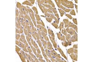 Immunohistochemistry of paraffin-embedded mouse heart using SLC2A4 antibody. (GLUT4 antibody  (C-Term))