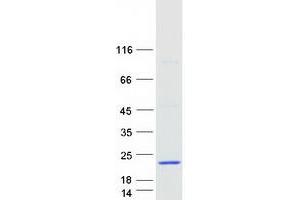 Validation with Western Blot (ALOX5AP Protein (Myc-DYKDDDDK Tag))