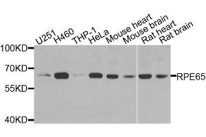 Western blot analysis of extracts of various cell lines, using RPE65 antibody. (RPE65 antibody)