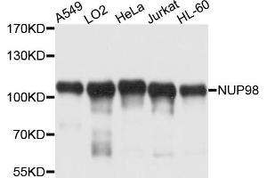 Western blot analysis of extracts of various cells lines, using NUP98 antibody. (NUP98 antibody)