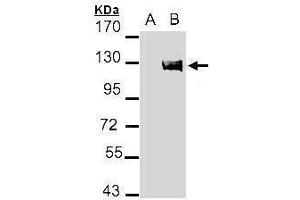 WB Image Western Blot analysis of AXL expression in transfected 293T cell line by AXL polyclonal antibody. (AXL antibody  (C-Term))