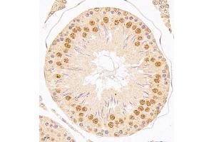 Immunohistochemistry of paraffin embedded rat testis using USP34 (ABIN7076115) at dilution of 1:700 (400x lens) (USP34 antibody)