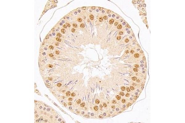 USP34 antibody